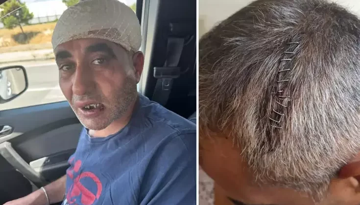 Eğlence mekanında tekme, yumruk ve sopalarla ölümüne dövüldü