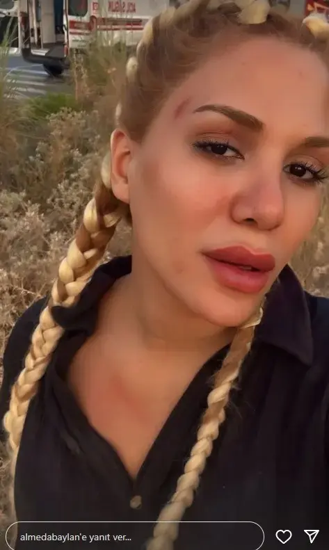 Survivor'ın eski yarışmacısı Almeda Baylan ölümden döndü